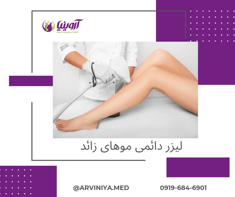 مرکز فروش پیشرفته ترین دستگاه لیزر پوست ایران