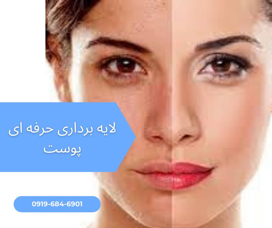 خرید دستگاه میکرودرم طوس طب از سایت نمایندگی میکرودرم