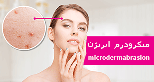 خرید دستگاه میکرودرم ابریژن