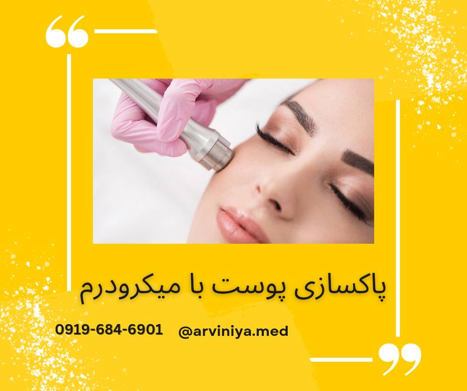 قیمت دستگاه میکرودرم پزشکی طوس طب