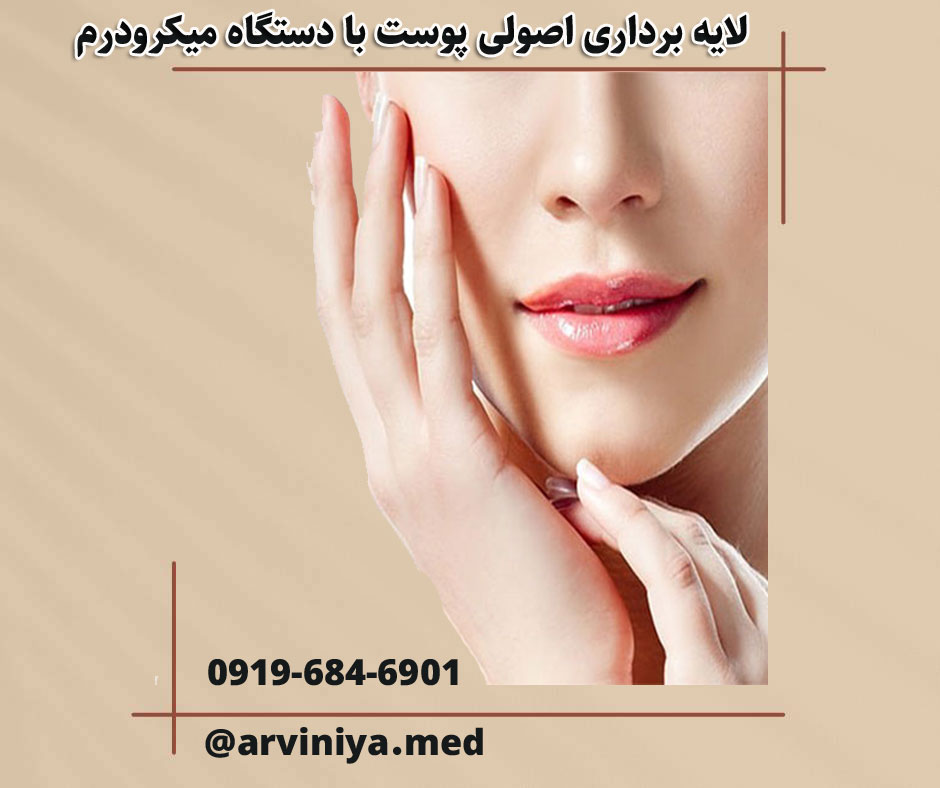 دستگاه میکرودرم ایرانی با شرایط فروش ویژه