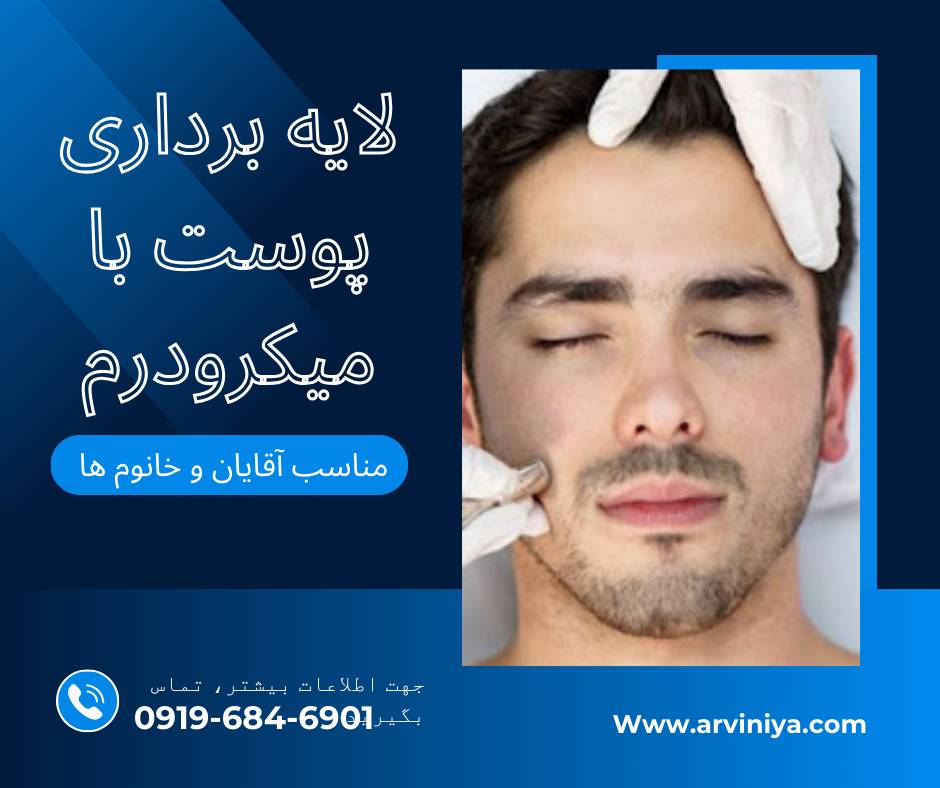 میکرودرم نایس درم حرفه ای ترین دستگاه میکرودرم ابریژن