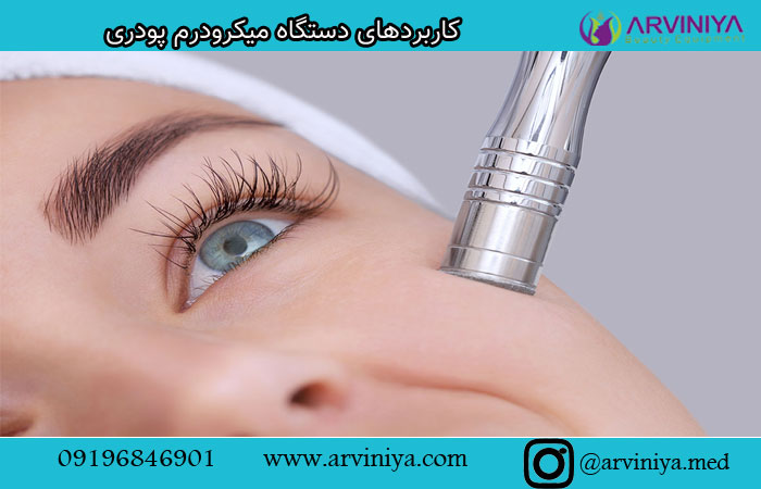 قیمت دستگاه میکرودرم ابریژن پودری| مکش بالا 