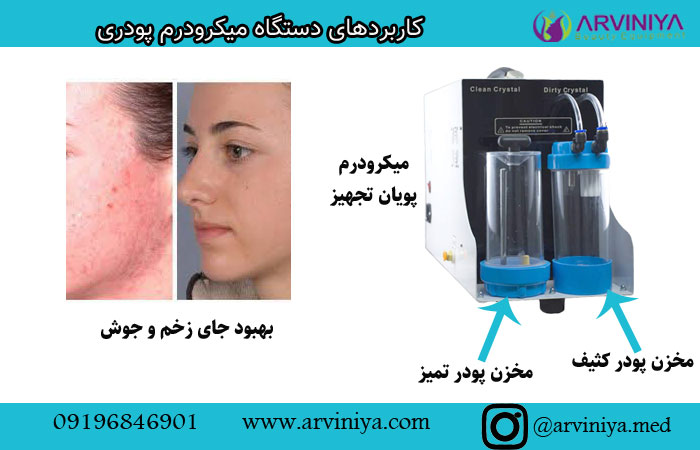 قیمت دستگاه میکرودرم ابریژن پودری| مکش بالا 