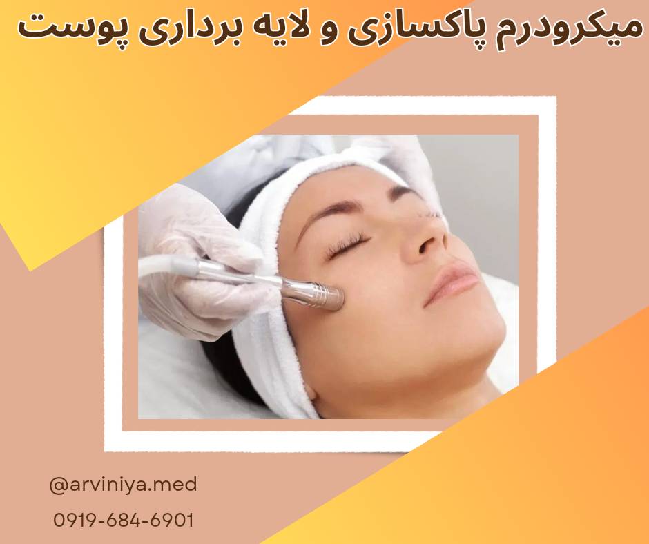 فروش دستگاه میکرودرم ارزان قیمت