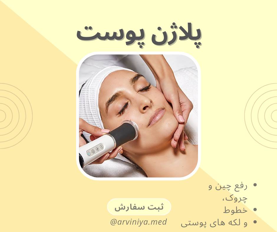 آخرین قیمت دستگاه پلاژن باکیفیت