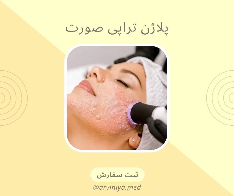 آخرین قیمت دستگاه پلاژن باکیفیت