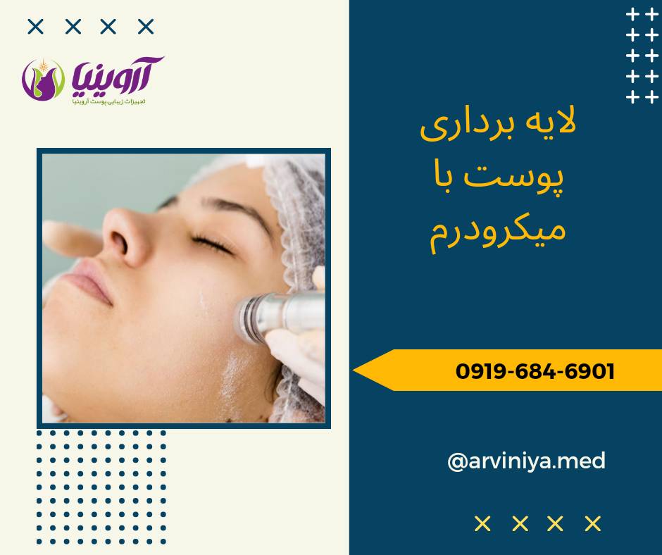 مرکز عرضه دستگاه میکرودرم صورت