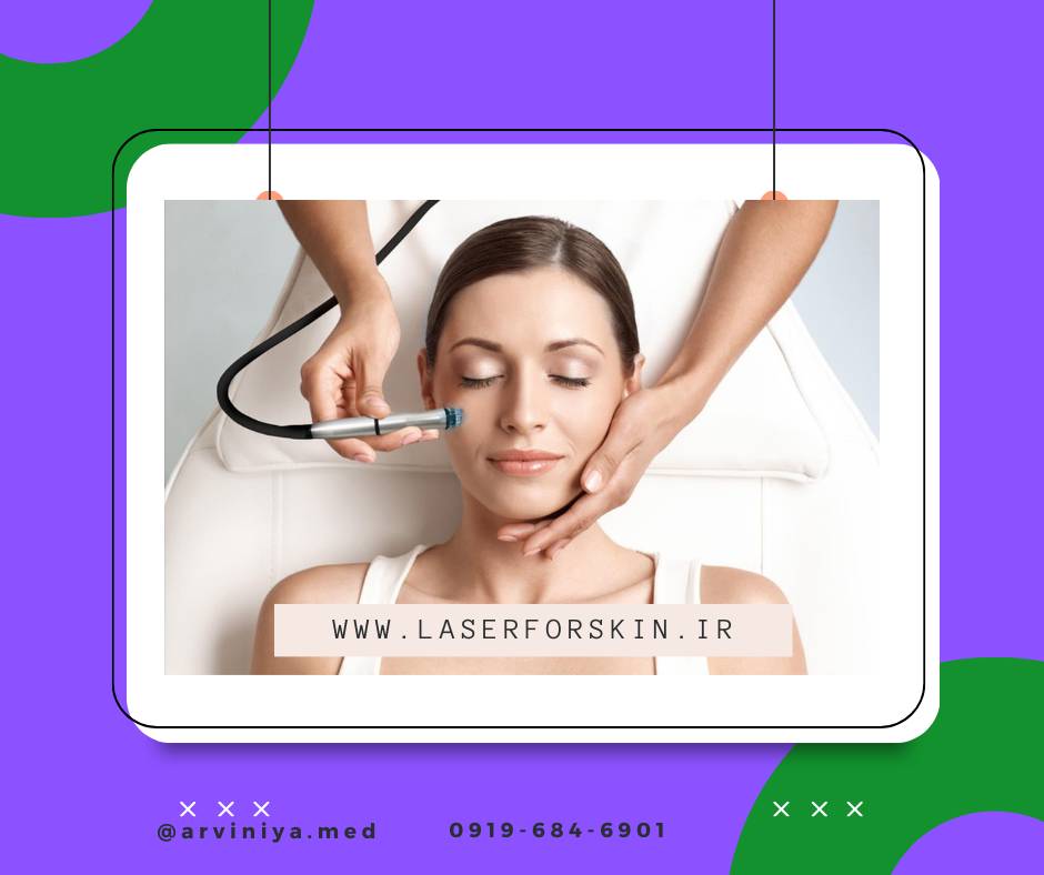 فروش انواع دستگاه میکرودرم ابریژن