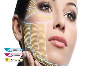 خرید اینترنتی دستگاه مینی هایفو