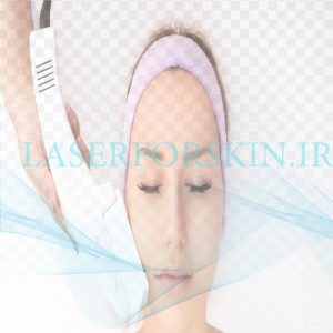 قیمت دستگاه هایفو دابلو اس