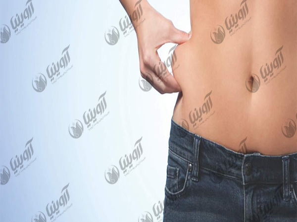 فروش دستگاه هایفو لاغری