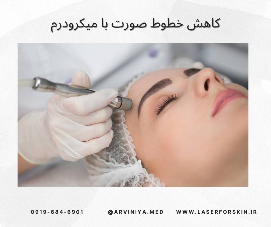 فروش دستگاه میکرودرم سالنی
