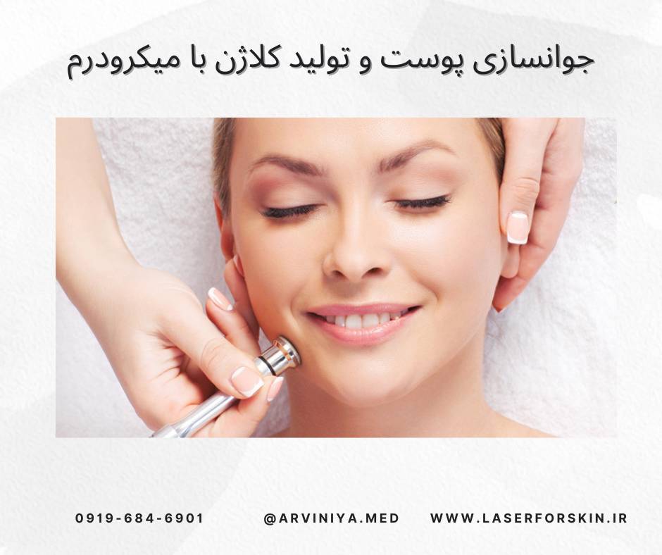 فروش دستگاه میکرودرم سالنی