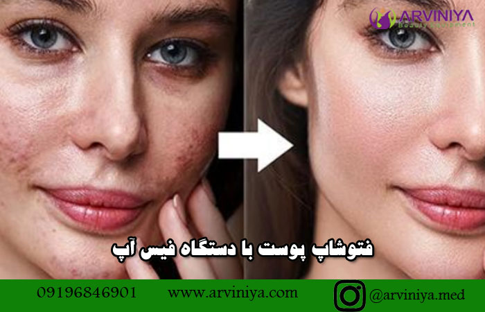 معرفی و مشخصات دستگاه فیس آپ face up قیمت نمایندگی
