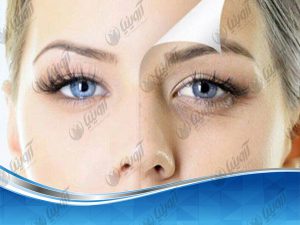 خرید دستگاه هایفو اولترا