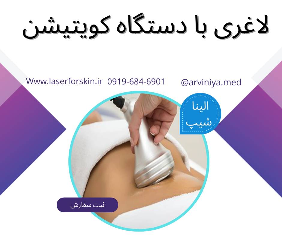 قیمت فروش دستگاه لاغری کویتیشن