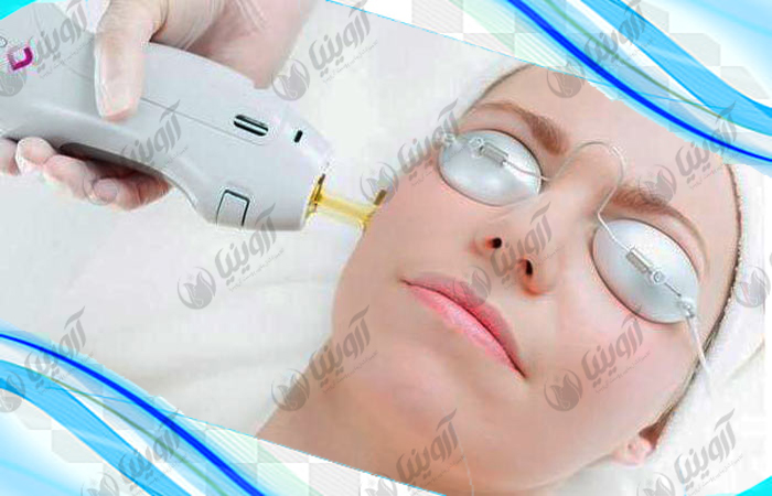 بزرگترین مرکز خرید و فروش دستگاه الکساندرایت دست دوم
