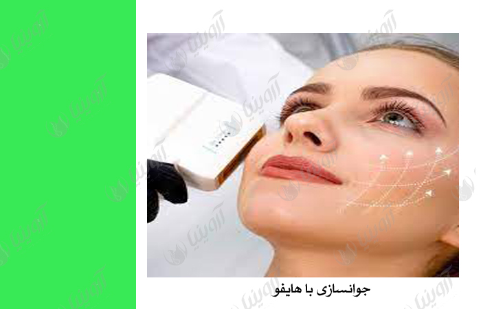 فروش بهترین مارک دستگاه هایفو اولترا