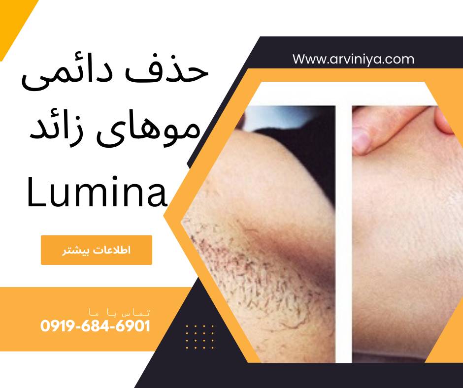 فروش دستگاه لیزر موهای زائد دایود 808 نانومتر