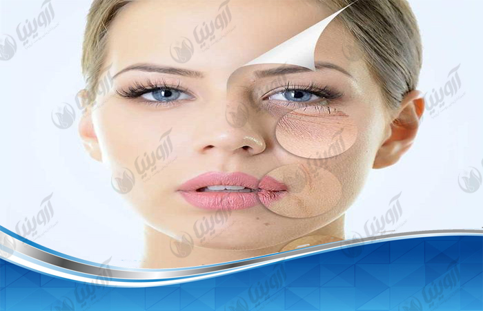 قیمت خرید بهترین مارک دستگاه ار اف فرکشنال