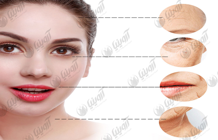نمایندگی فروش دستگاه هایفو اولتراپی