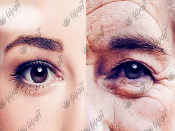 فروش دستگاه کربوکسی تراپی ۲۰۲۰