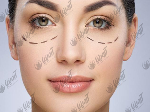 فروش دستگاه کربوکسی تراپی ۲۰۲۰