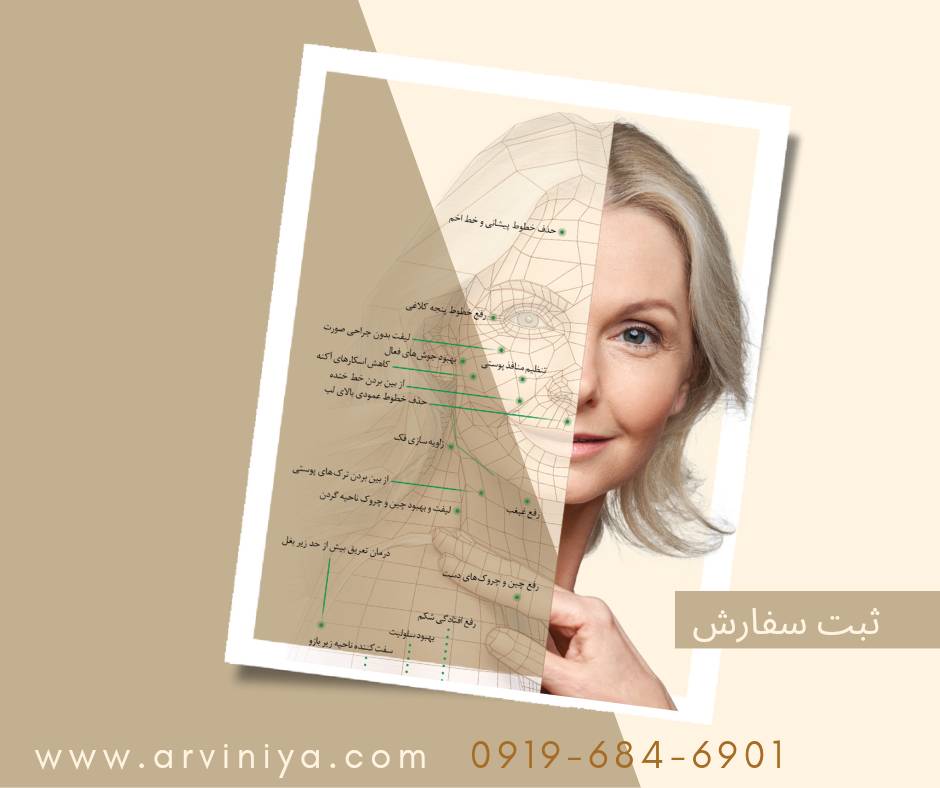 مرکز فروش انواع دستگاه آر اف فرکشنال