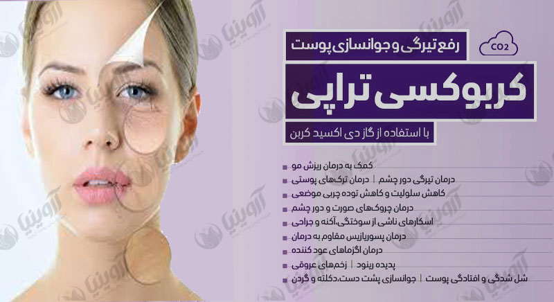 وارد کننده دستگاه کربوکسی تراپی صورت