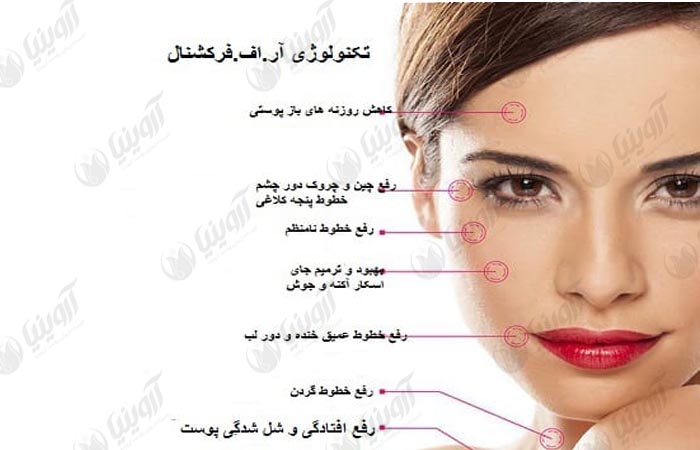 فروش بهترین دستگاه آر اف فرکشنال سوزنی