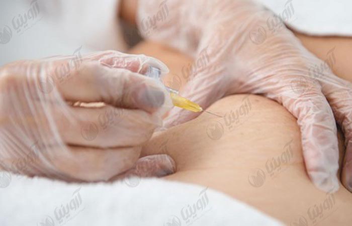 قیمت دستگاه کربوکسی تراپی برای لاغری