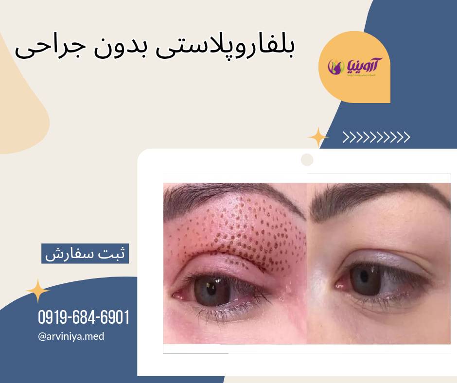نمایندگی فروش انواع دستگاه پلاسما جت مدیکال