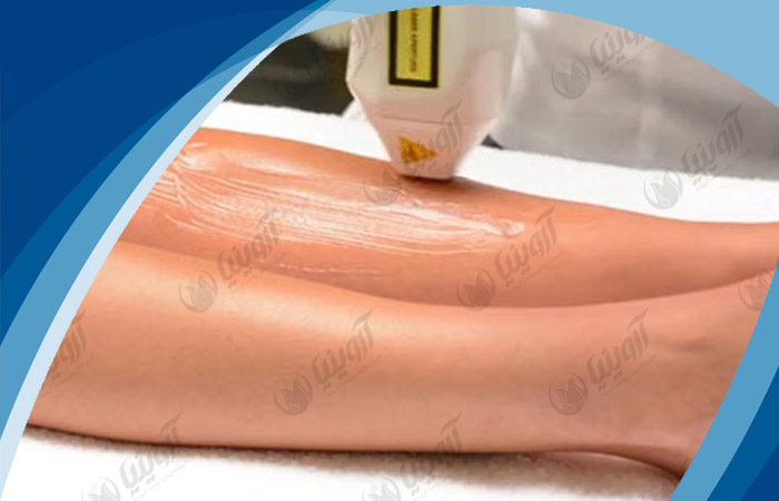 نمایندگی فروش دستگاه لیزر دایود رکسانا