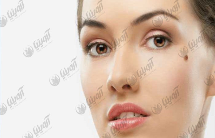 چه دستگاه آر اف خال برداری بخریم؟