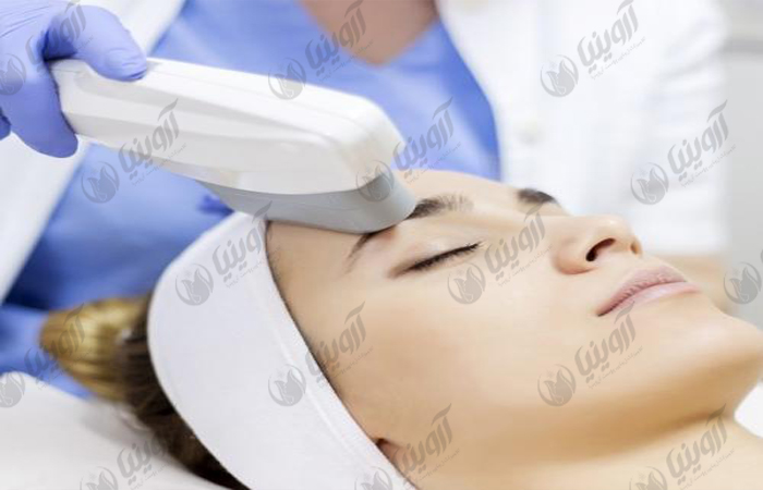 قیمت دستگاه لیزر آی پی ال IPL رومیزی