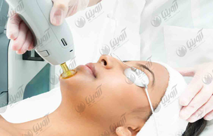 قیمت روز دستگاه لیزر دایود کره ای سلن selen