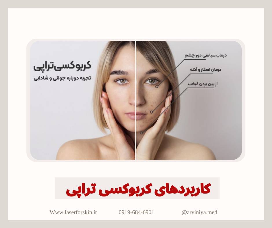مشاوره خرید بهترین دستگاه کربوکسی تراپی کلینیکی