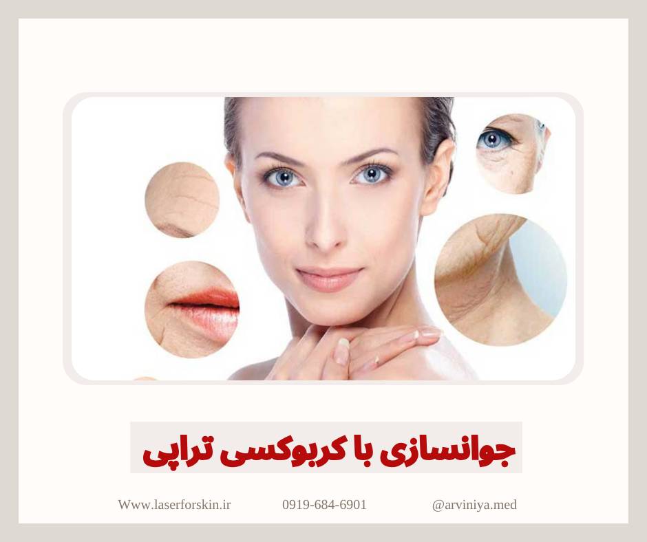 مشاوره خرید بهترین دستگاه کربوکسی تراپی کلینیکی