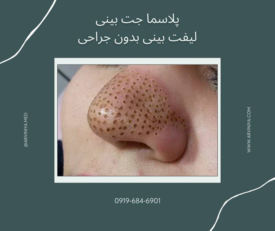 قیمت دستگاه پلاسما جت فایربولت پلاس