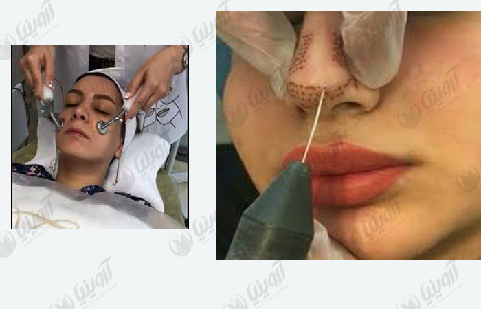 شرکت فروش تجهیزات زیبایی پوست آروینیا