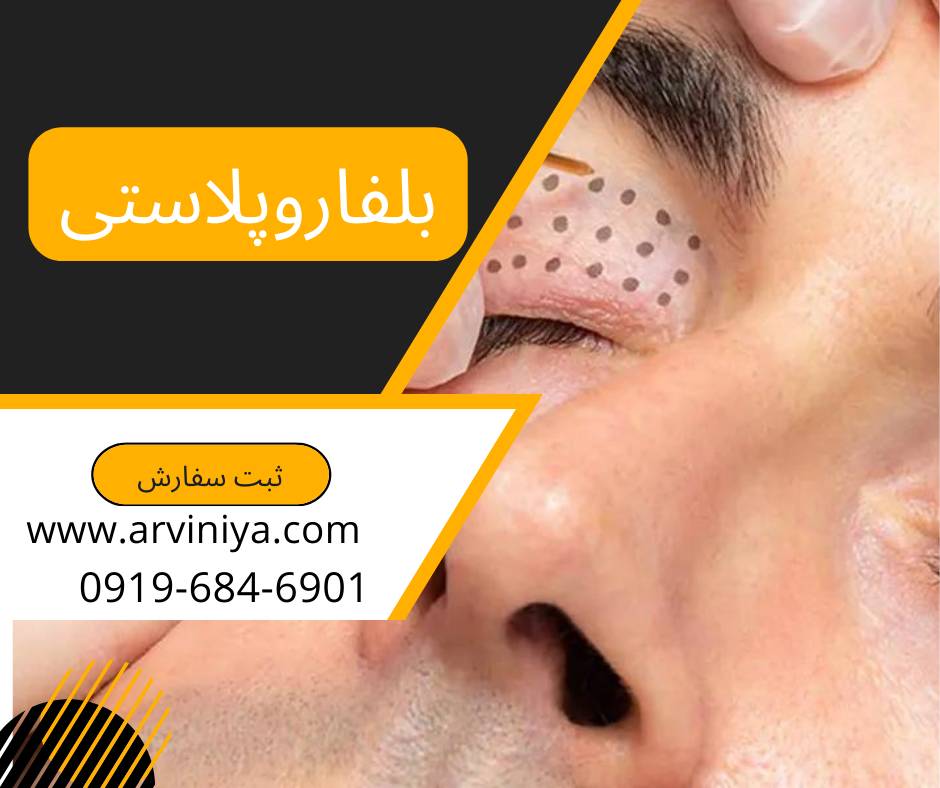 خرید بهترین مارک دستگاه پلاسما جت