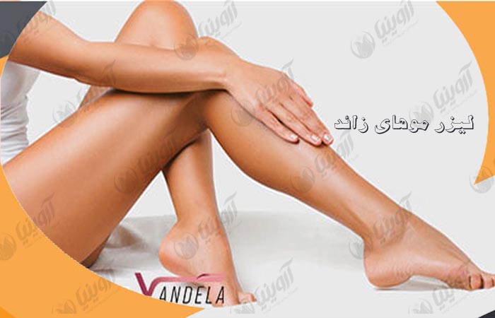 خرید دستگاه لیزر وندلا