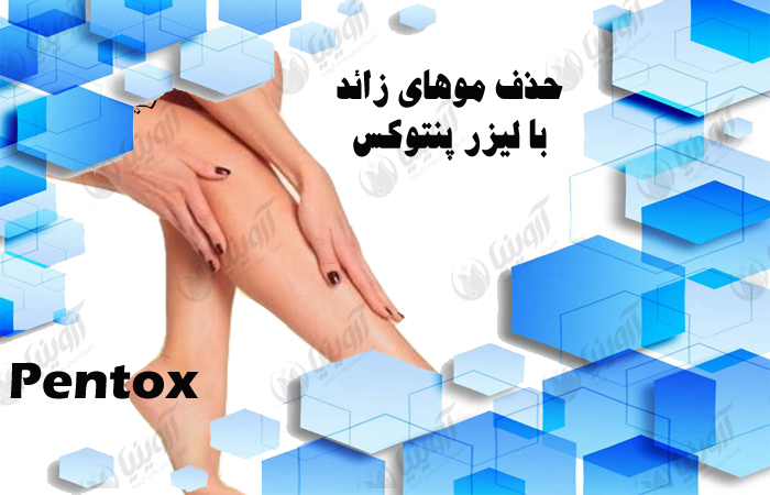 خرید دستگاه لیزر پنتوکس