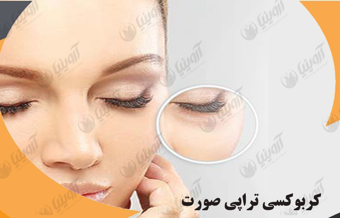 قیمت دستگاه کربوکسی پالوما