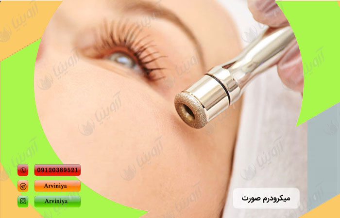 فروش دستگاه میکرودرم نیمه دیجیتال