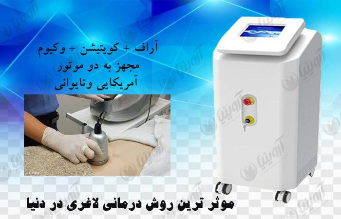 قیمت بهترین دستگاه کویتیشن