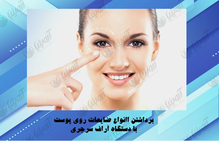 قیمت دستگاه آراف سرجری