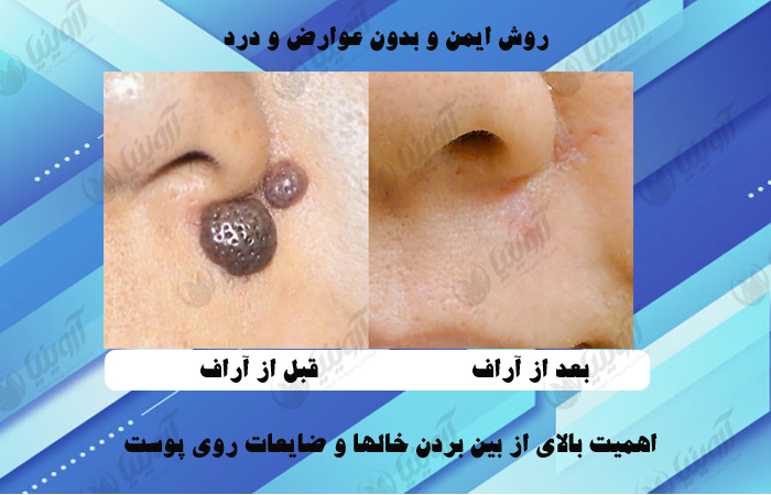 قیمت دستگاه آراف سرجری