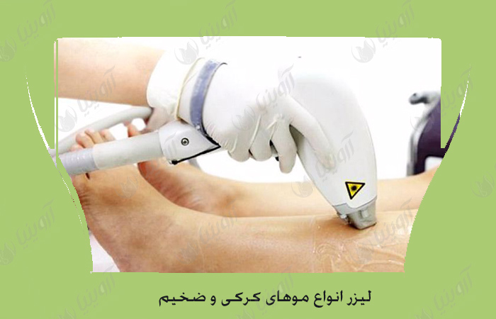 قیمت دستگاه لیزر موهای زائد الکس دایود